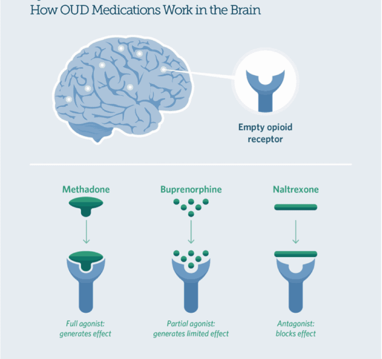 mat-medication-assisted-treatment